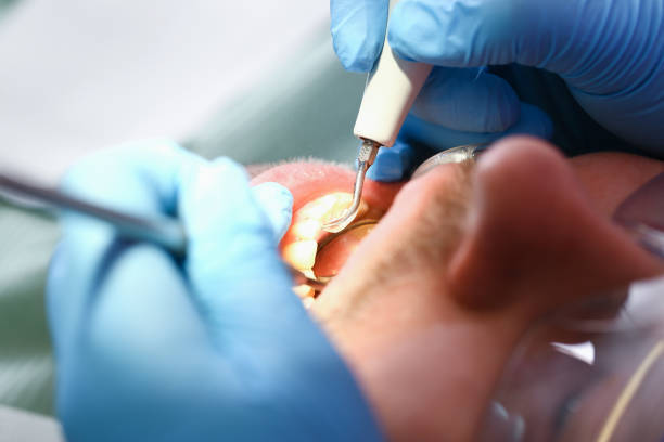 Best Pediatric Emergency Dentist in York, AL