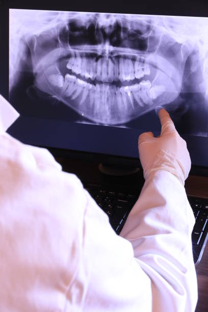 Best Emergency Dental Care for Broken or Chipped Teeth in York, AL